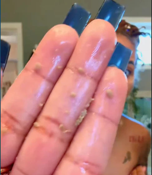 Grey buildup rolling off during dry underarm peel application