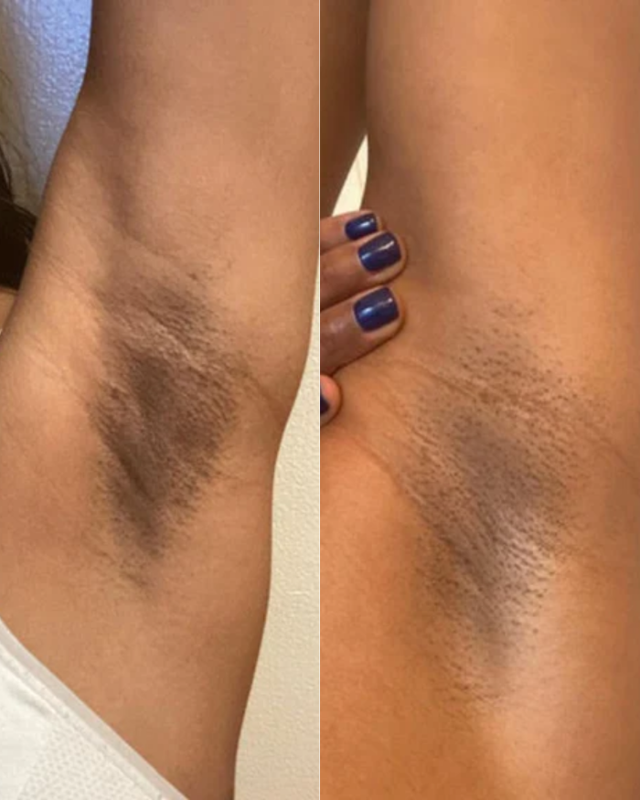 Sleeveless payoff after dark underarm routine